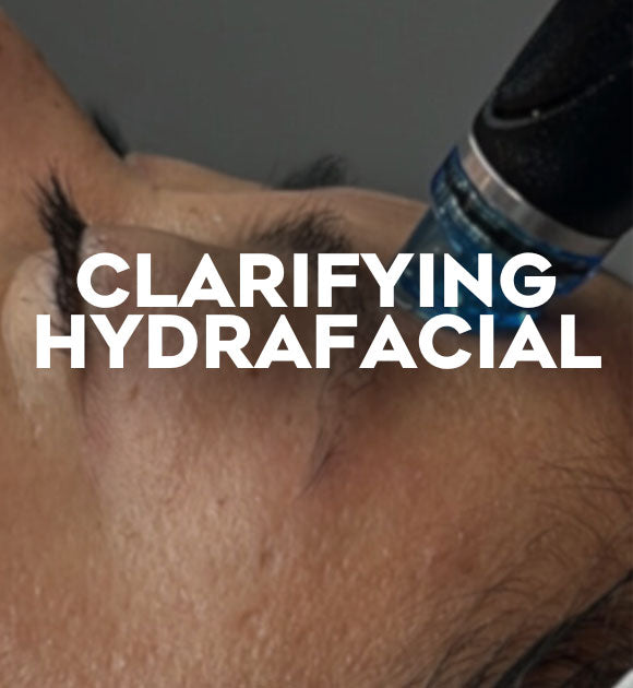 Clarifying Hydrafacial